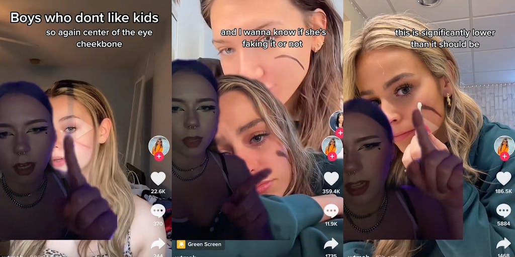 😨 Is TikTok’s ‘Scar Girl’ faking her scar for clout?